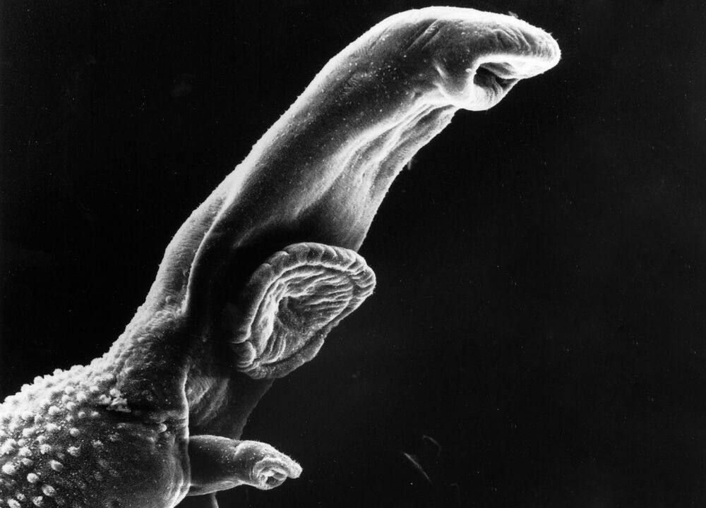 O Schistosoma é um parasita cujo ciclo de vida requer um hospedeiro intermediário. 