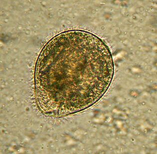 Balantidium é o maior protozoário parasita