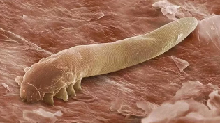 Os parasitas no corpo humano